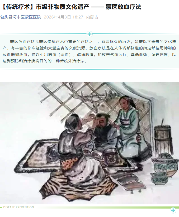 dd7c733aab03a65f1dc29899278e4fc9.png